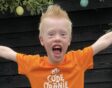 Joas anders